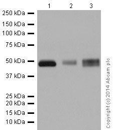 Western blot - Anti-TPP1 antibody [EPR16537] (AB195234), expandable thumbnail