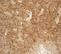 Immunohistochemistry (Formalin/PFA-fixed paraffin-embedded sections) - Anti-TPPP antibody [EPR3315] (AB119987)