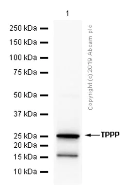 Western blot - Anti-TPPP antibody [EPR3315] (AB119987)