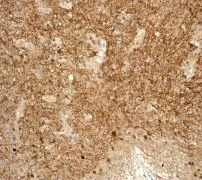 Immunohistochemistry (Formalin/PFA-fixed paraffin-embedded sections) - Anti-TPPP antibody [EPR3315] - BSA and Azide free (AB247949)