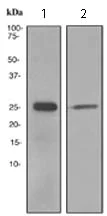Western blot - Anti-TPPP antibody [EPR3315] - BSA and Azide free (AB247949)