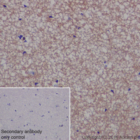 Immunohistochemistry (Formalin/PFA-fixed paraffin-embedded sections) - Anti-TPPP antibody [EPR3316] (AB92305)