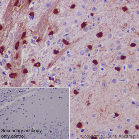 Immunohistochemistry (Formalin/PFA-fixed paraffin-embedded sections) - Anti-TPPP antibody [EPR3316] (AB92305), expandable thumbnail