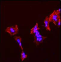 Immunocytochemistry/ Immunofluorescence - Anti-TPPP antibody [EPR3316] - BSA and Azide free (AB238958)