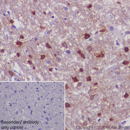 Immunohistochemistry (Formalin/PFA-fixed paraffin-embedded sections) - Anti-TPPP antibody [EPR3316] - BSA and Azide free (AB238958), expandable thumbnail