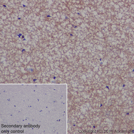 Immunohistochemistry (Formalin/PFA-fixed paraffin-embedded sections) - Anti-TPPP antibody [EPR3316] - BSA and Azide free (ab238958), expandable thumbnail