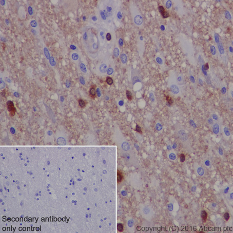 Immunohistochemistry (Formalin/PFA-fixed paraffin-embedded sections) - Anti-TPPP antibody [EPR3316] - BSA and Azide free (AB238958), expandable thumbnail