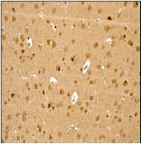 Immunohistochemistry (Formalin/PFA-fixed paraffin-embedded sections) - Anti-TPPP antibody [EPR3316] - BSA and Azide free (ab238958), expandable thumbnail