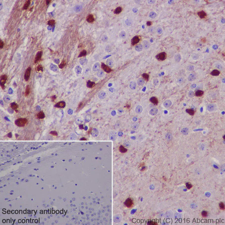 Immunohistochemistry (Formalin/PFA-fixed paraffin-embedded sections) - Anti-TPPP antibody [EPR3316] - BSA and Azide free (AB238958)