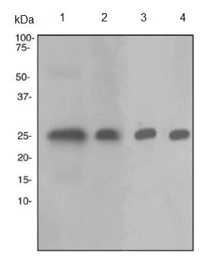Western blot - Anti-TPPP antibody [EPR3316] - BSA and Azide free (AB238958)