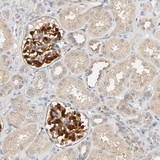 Immunohistochemistry (Formalin/PFA-fixed paraffin-embedded sections) - Anti-TPPP2 antibody (AB121215)