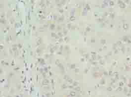 Immunohistochemistry (Formalin/PFA-fixed paraffin-embedded sections) - Anti-TPPP2 antibody (AB236887)