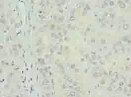 Immunohistochemistry (Formalin/PFA-fixed paraffin-embedded sections) - Anti-TPPP2 antibody (AB236887)