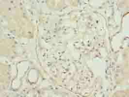 Immunohistochemistry (Formalin/PFA-fixed paraffin-embedded sections) - Anti-TPPP2 antibody (AB236887)