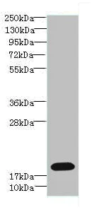 Western blot - Anti-TPPP2 antibody (AB236887)