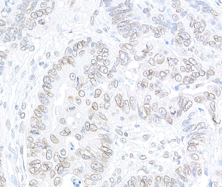 Immunohistochemistry (Formalin/PFA-fixed paraffin-embedded sections) - Anti-TPR antibody (AB264153)