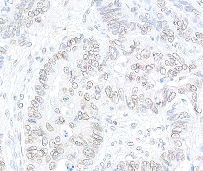 Immunohistochemistry (Formalin/PFA-fixed paraffin-embedded sections) - Anti-TPR antibody (AB264153)