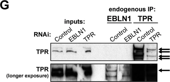 Western blot - Anti-TPR antibody (AB70610)