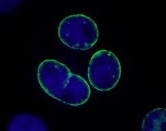 Immunocytochemistry/ Immunofluorescence - Anti-TPR antibody (AB84516)