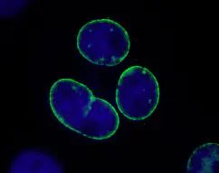 Immunocytochemistry/ Immunofluorescence - Anti-TPR antibody (AB84516)