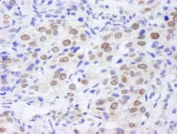 Immunohistochemistry (Formalin/PFA-fixed paraffin-embedded sections) - Anti-TPR antibody (AB84516)