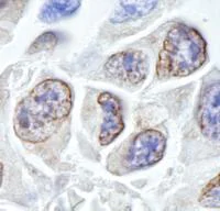 Immunohistochemistry (Formalin/PFA-fixed paraffin-embedded sections) - Anti-TPR antibody (AB84516)