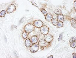 Immunohistochemistry (Formalin/PFA-fixed paraffin-embedded sections) - Anti-TPR antibody (AB84516)