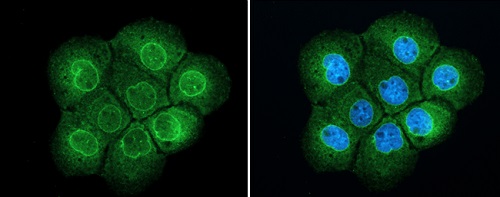 Immunocytochemistry/ Immunofluorescence - Anti-TPR antibody - C-terminal (AB229352)