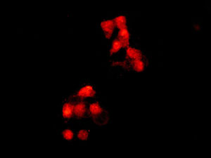 Immunocytochemistry/ Immunofluorescence - Anti-TPR antibody [EPR8982] (AB170940), expandable thumbnail
