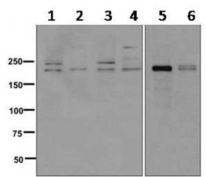 Western blot - Anti-TPR antibody [EPR8982] (AB170940), expandable thumbnail
