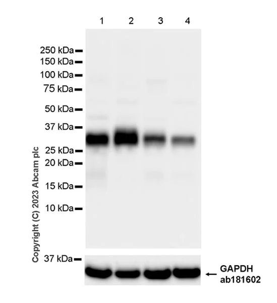 Western blot - Anti-TPSB2 antibody [EPR28111-57] (AB314321)