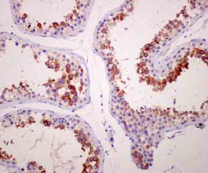 Immunohistochemistry (Formalin/PFA-fixed paraffin-embedded sections) - Anti-TPTE antibody [EPR11867(2)] - BSA and Azide free (AB250148), expandable thumbnail