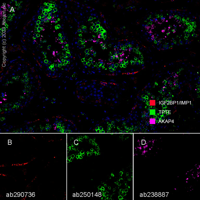 Multiplex immunohistochemistry - Anti-TPTE antibody [EPR11867(2)] - BSA and Azide free (AB250148)