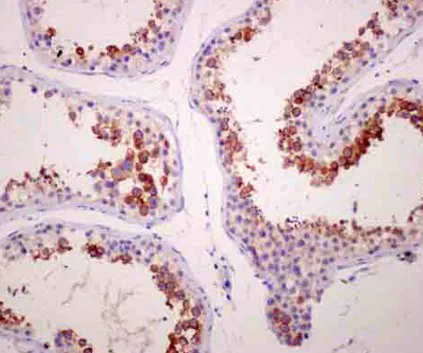 Immunohistochemistry (Formalin/PFA-fixed paraffin-embedded sections) - Anti-TPTE antibody [EPR11867(2)] - N-terminal (AB180137)