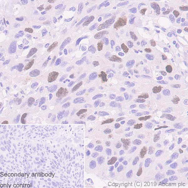 Immunohistochemistry (Formalin/PFA-fixed paraffin-embedded sections) - Anti-TPX2 antibody [EPR23180-4] (AB252945)