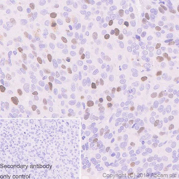 Immunohistochemistry (Formalin/PFA-fixed paraffin-embedded sections) - Anti-TPX2 antibody [EPR23180-4] (AB252945)