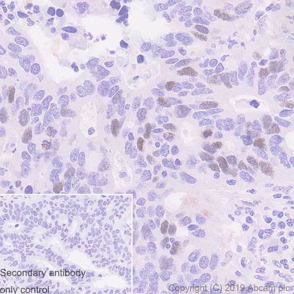 Immunohistochemistry (Formalin/PFA-fixed paraffin-embedded sections) - Anti-TPX2 antibody [EPR23180-4] (AB252945)