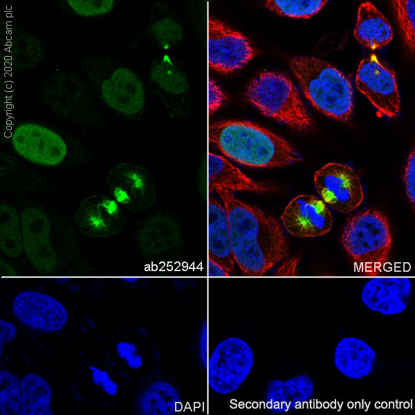 Immunocytochemistry/ Immunofluorescence - Anti-TPX2 antibody [EPR23182-47] (AB252944), expandable thumbnail
