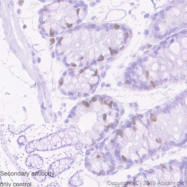 Immunohistochemistry (Formalin/PFA-fixed paraffin-embedded sections) - Anti-TPX2 antibody [EPR23182-47] (ab252944), expandable thumbnail