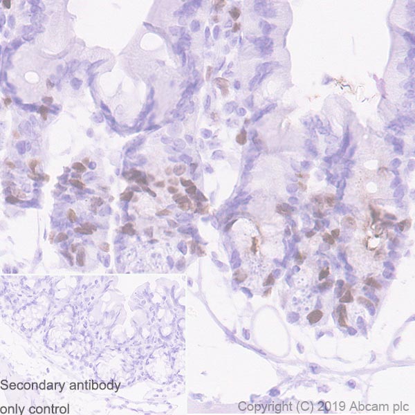 Immunohistochemistry (Formalin/PFA-fixed paraffin-embedded sections) - Anti-TPX2 antibody [EPR23182-47] (AB252944), expandable thumbnail