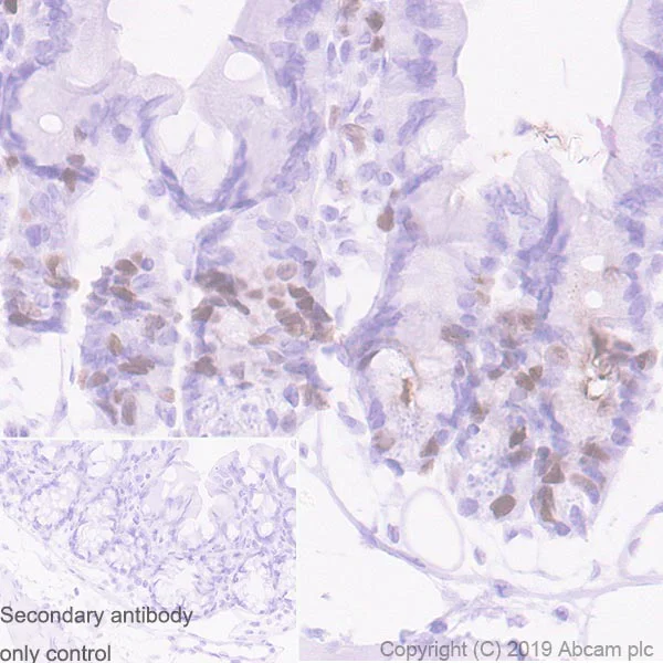 Immunohistochemistry (Formalin/PFA-fixed paraffin-embedded sections) - Anti-TPX2 antibody [EPR23182-47] (AB252944)