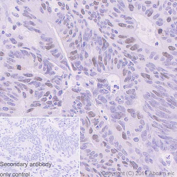 Immunohistochemistry (Formalin/PFA-fixed paraffin-embedded sections) - Anti-TPX2 antibody [EPR23182-47] (ab252944), expandable thumbnail