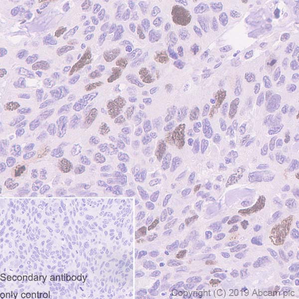 Immunohistochemistry (Formalin/PFA-fixed paraffin-embedded sections) - Anti-TPX2 antibody [EPR23182-47] (ab252944), expandable thumbnail