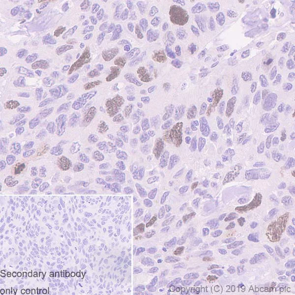 Immunohistochemistry (Formalin/PFA-fixed paraffin-embedded sections) - Anti-TPX2 antibody [EPR23182-47] (AB252944)