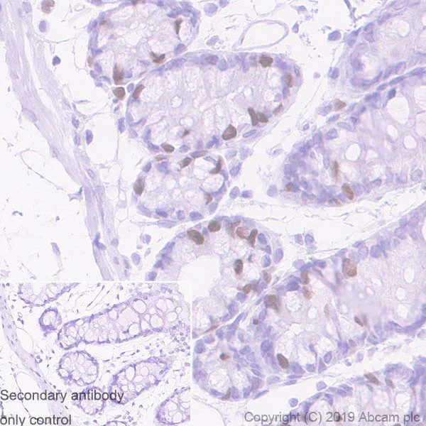 Immunohistochemistry (Formalin/PFA-fixed paraffin-embedded sections) - Anti-TPX2 antibody [EPR23182-47] - BSA and Azide free (AB270613)