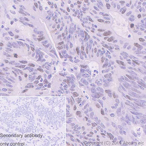 Immunohistochemistry (Formalin/PFA-fixed paraffin-embedded sections) - Anti-TPX2 antibody [EPR23182-47] - BSA and Azide free (AB270613)