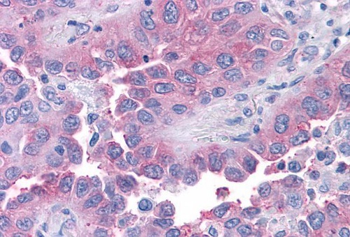 Immunohistochemistry (Formalin/PFA-fixed paraffin-embedded sections) - Anti-TR1 antibody (AB230788), expandable thumbnail