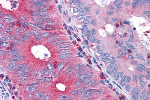 Immunohistochemistry (Formalin/PFA-fixed paraffin-embedded sections) - Anti-TR1 antibody (AB230788), expandable thumbnail