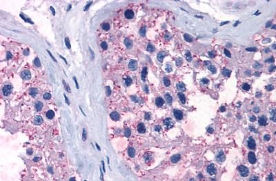 Immunohistochemistry (Formalin/PFA-fixed paraffin-embedded sections) - Anti-TR1 antibody (AB230788), expandable thumbnail