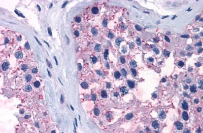 Immunohistochemistry (Formalin/PFA-fixed paraffin-embedded sections) - Anti-TR1 antibody (AB230788)
